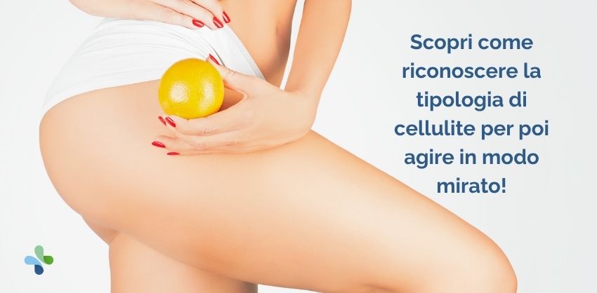 Cellulite: non sei “sbagliata”! Sei in un corpo che cambia!